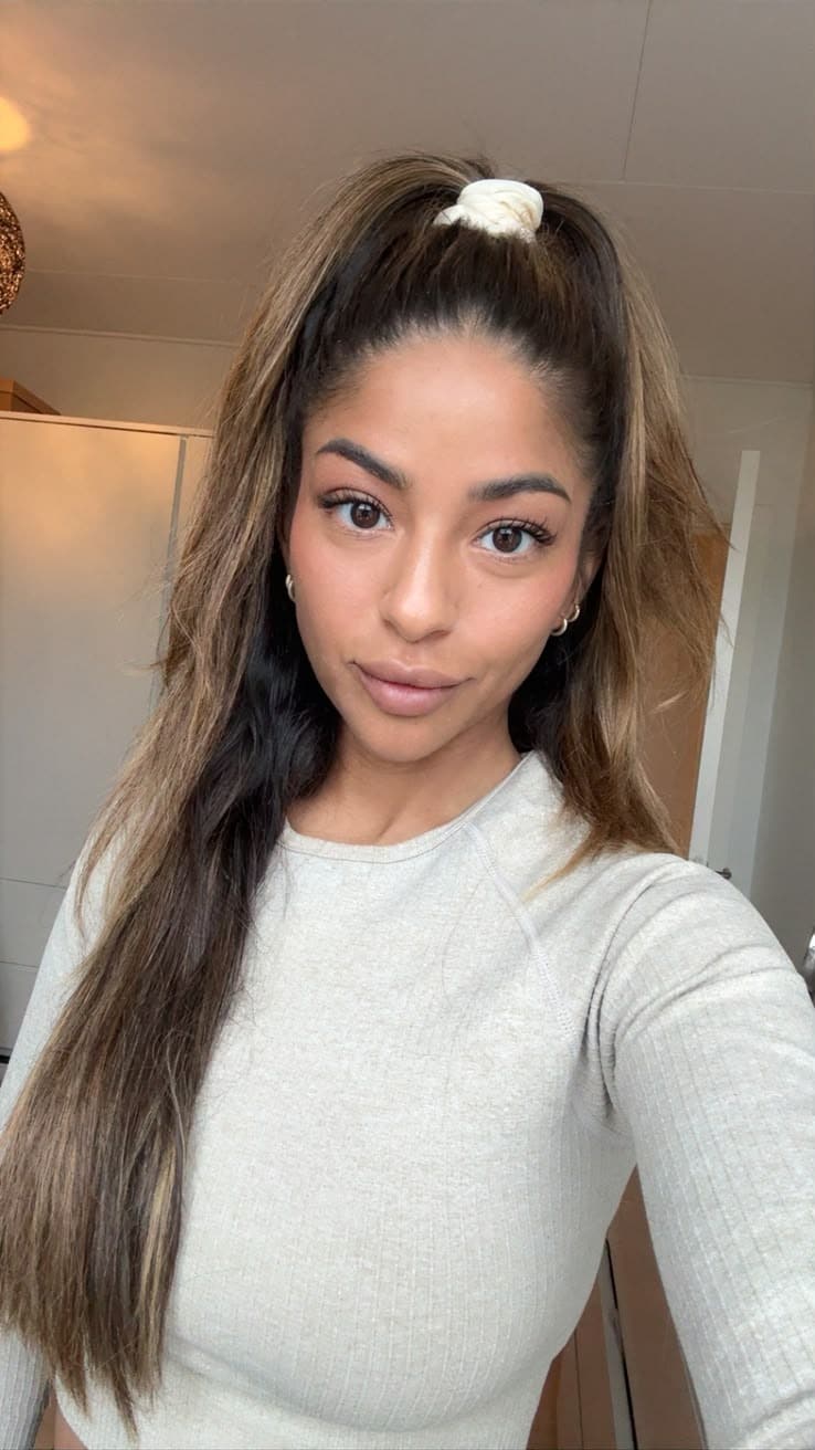 Melisa, kosmetisk sygeplejerske hos Dr. Wimmer Aesthetics